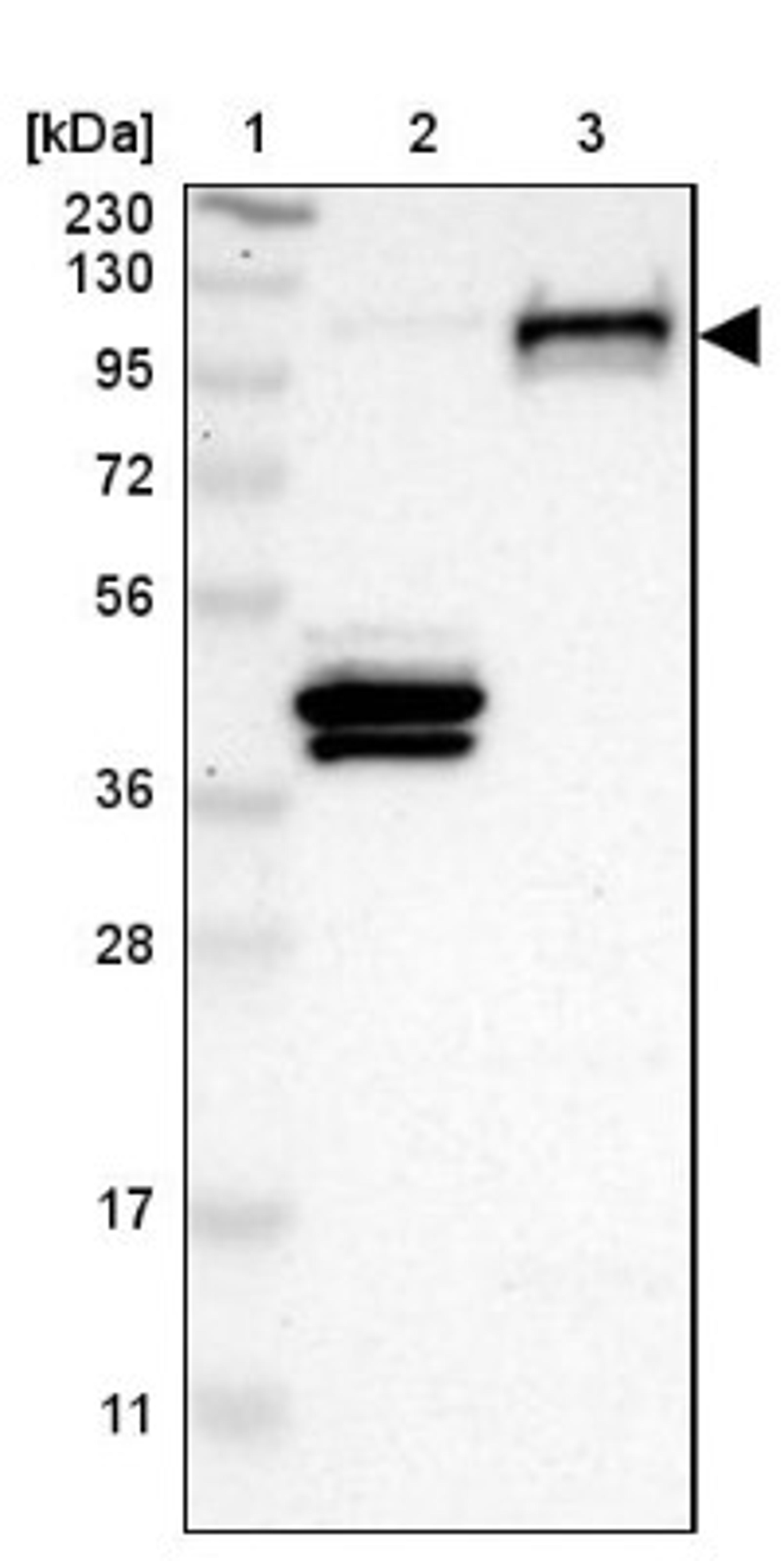 Western Blot: Sortilin Antibody [NBP1-89745] - Lane 1: Marker [kDa] 230, 130, 95, 72, 56, 36, 28, 17, 11<br/>Lane 2: Human cell line RT-4<br/>Lane 3: Human cell line U-251MG sp