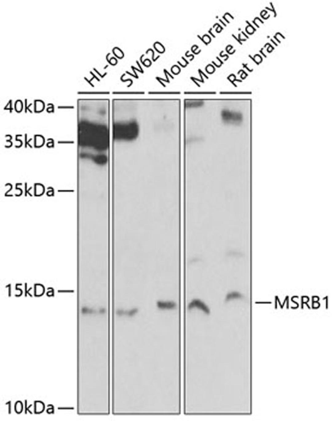 Western blot - MSRB1 Antibody (A6737)