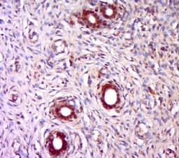 Immunohistochemical staining of Rat uterus tissue using TPRKB antibody.