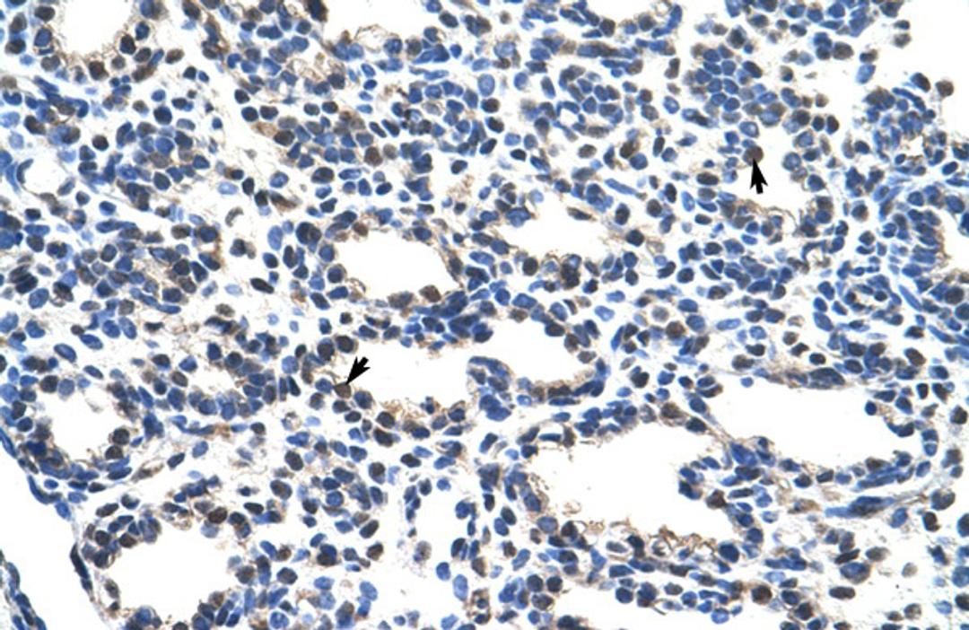 Antibody used in IHC on Human Lung.