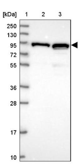 Western Blot: C3orf20 Antibody [NBP1-90544] - Lane 1: Marker [kDa] 250, 130, 95, 72, 55, 36, 28, 17, 10<br/>Lane 2: Human cell line RT-4<br/>Lane 3: Human cell line U-251MG sp