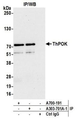 Detection of human ThPOK by western blot of immunoprecipitates.