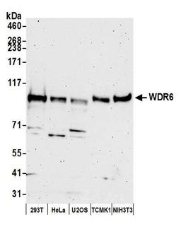 Detection of human and mouse WDR6 by WB.