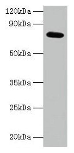 Western blot. All lanes: ARPC3 antibody at 2µg/ml + 293T whole cell lysate. Secondary. Goat polyclonal to rabbit IgG at 1/15000 dilution. Predicted band size: 21 kDa. Observed band size: 75 kDa