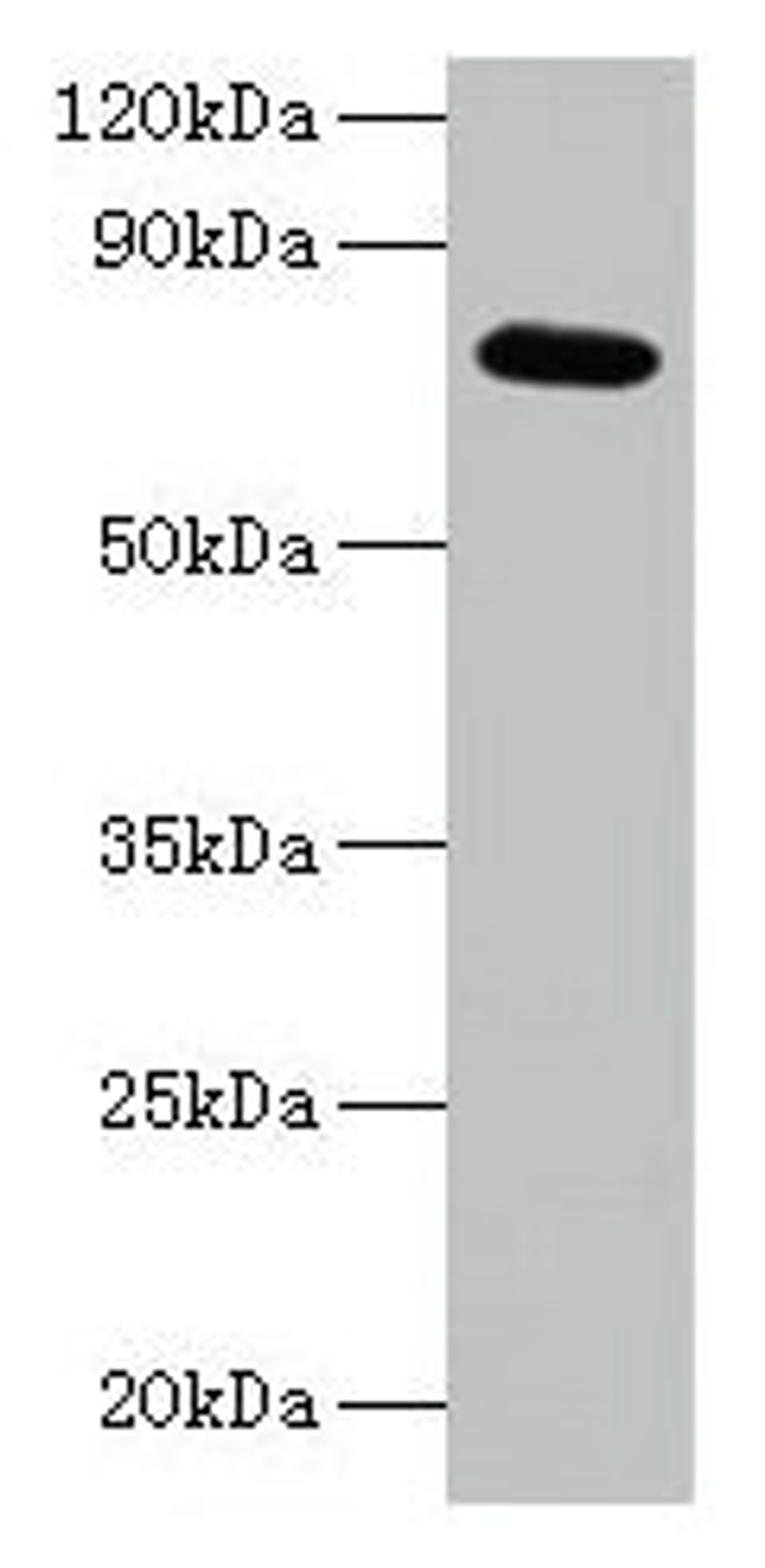 Western blot. All lanes: ARPC3 antibody at 2µg/ml + 293T whole cell lysate. Secondary. Goat polyclonal to rabbit IgG at 1/15000 dilution. Predicted band size: 21 kDa. Observed band size: 75 kDa