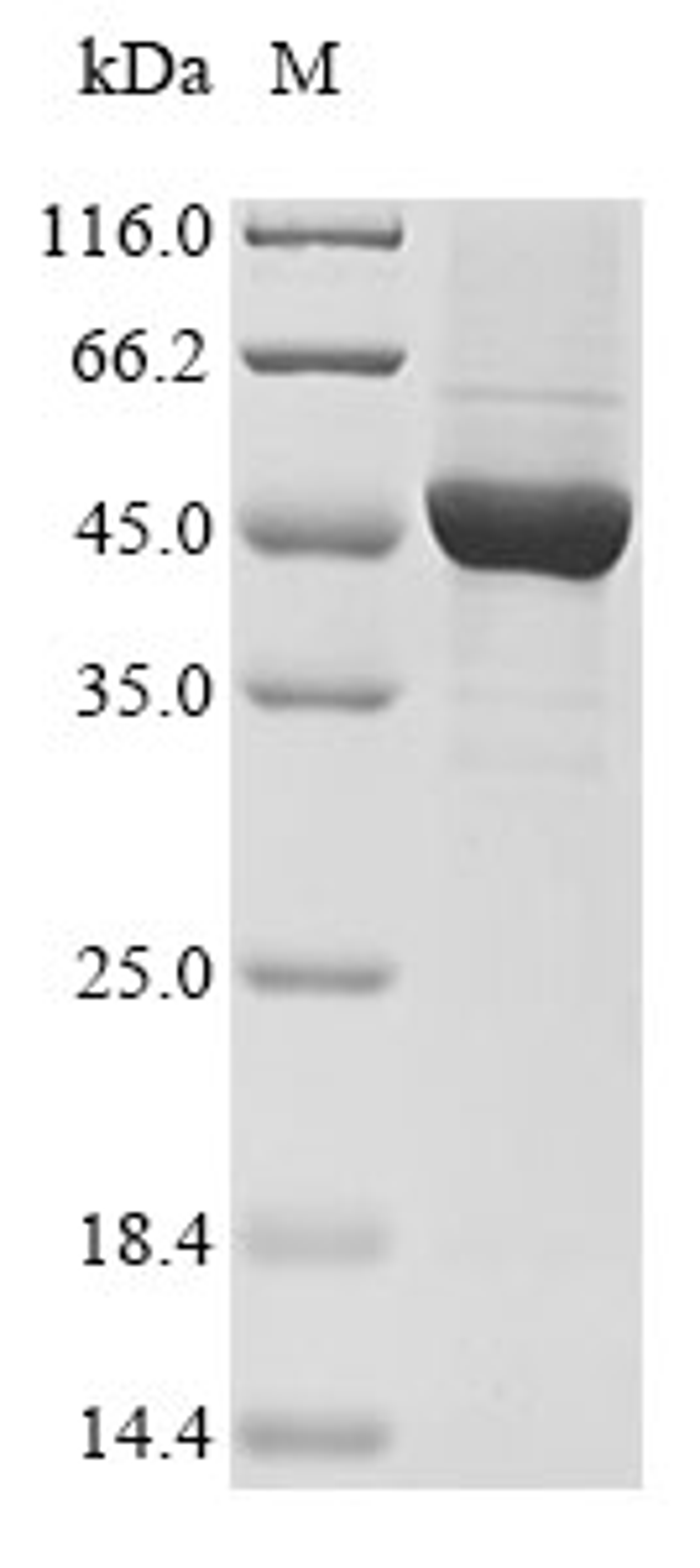 (Tris-Glycine gel) Discontinuous SDS-PAGE (reduced) with 5% enrichment gel and 15% separation gel.