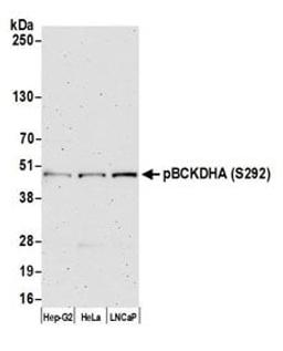 Detection of human pBCKDHA (S292) by western blot.