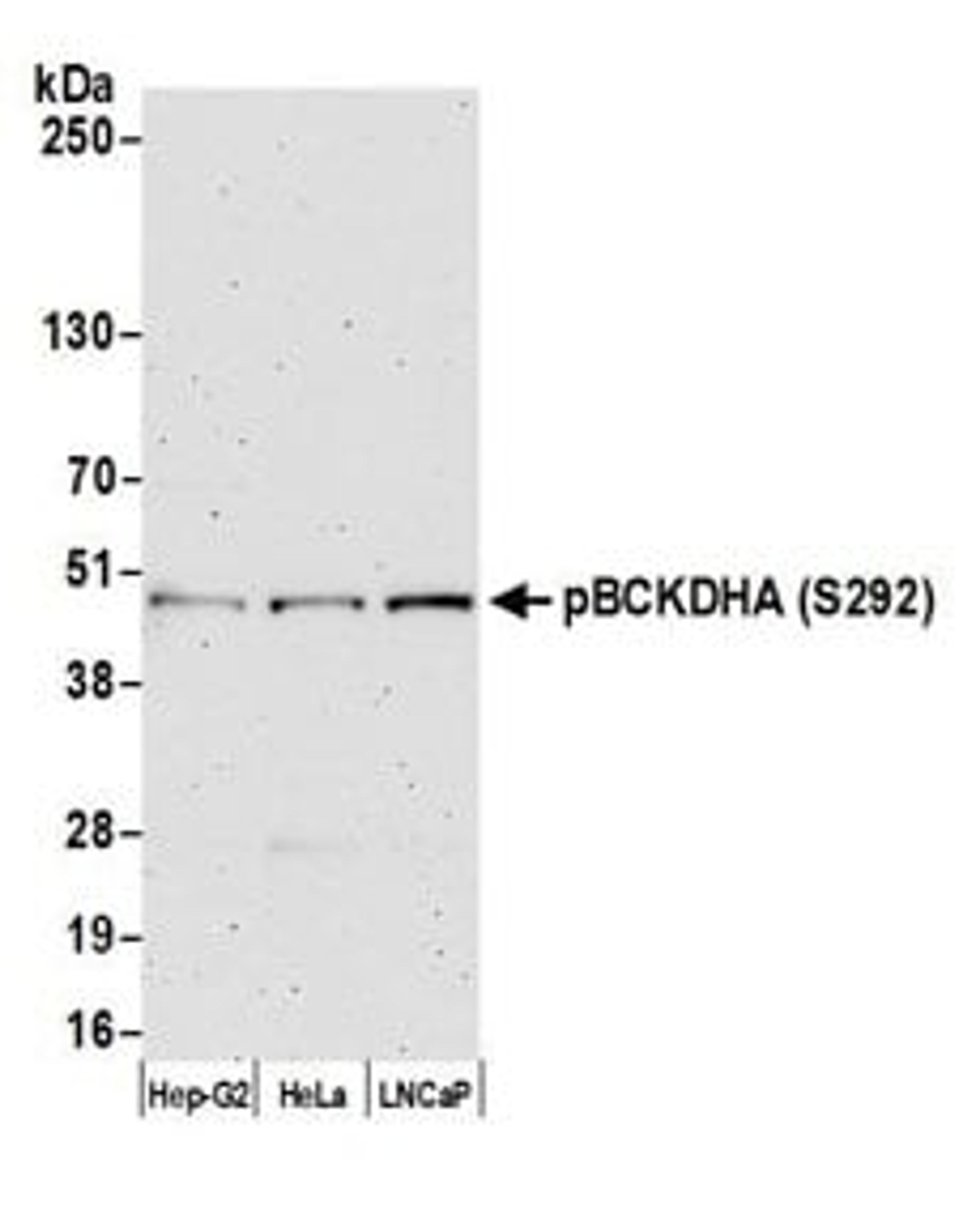 Detection of human pBCKDHA (S292) by western blot.