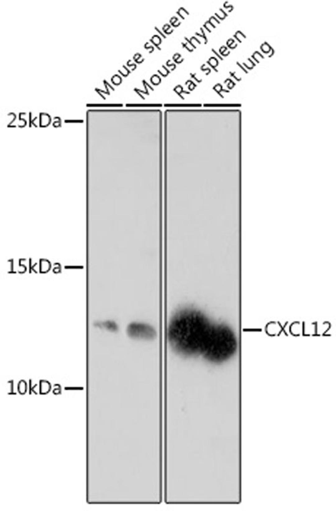 Western blot - CXCL12 antibody (A18225)