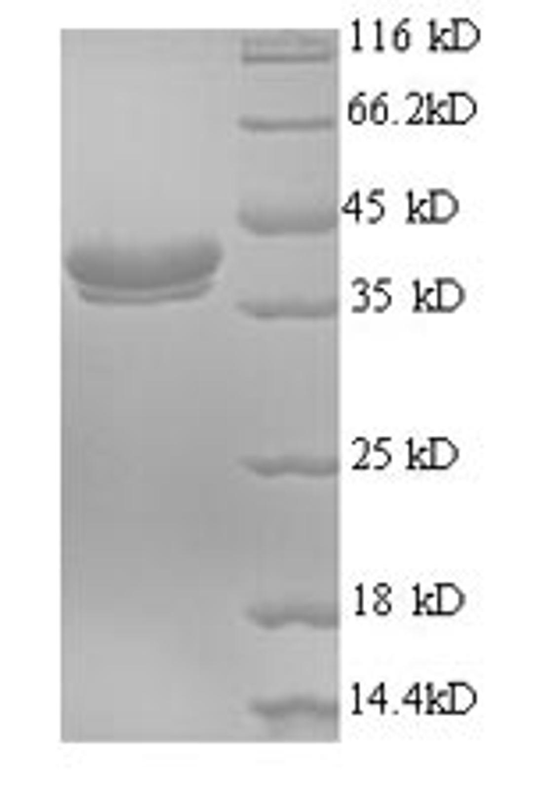 (Tris-Glycine gel) Discontinuous SDS-PAGE (reduced) with 5% enrichment gel and 15% separation gel.
