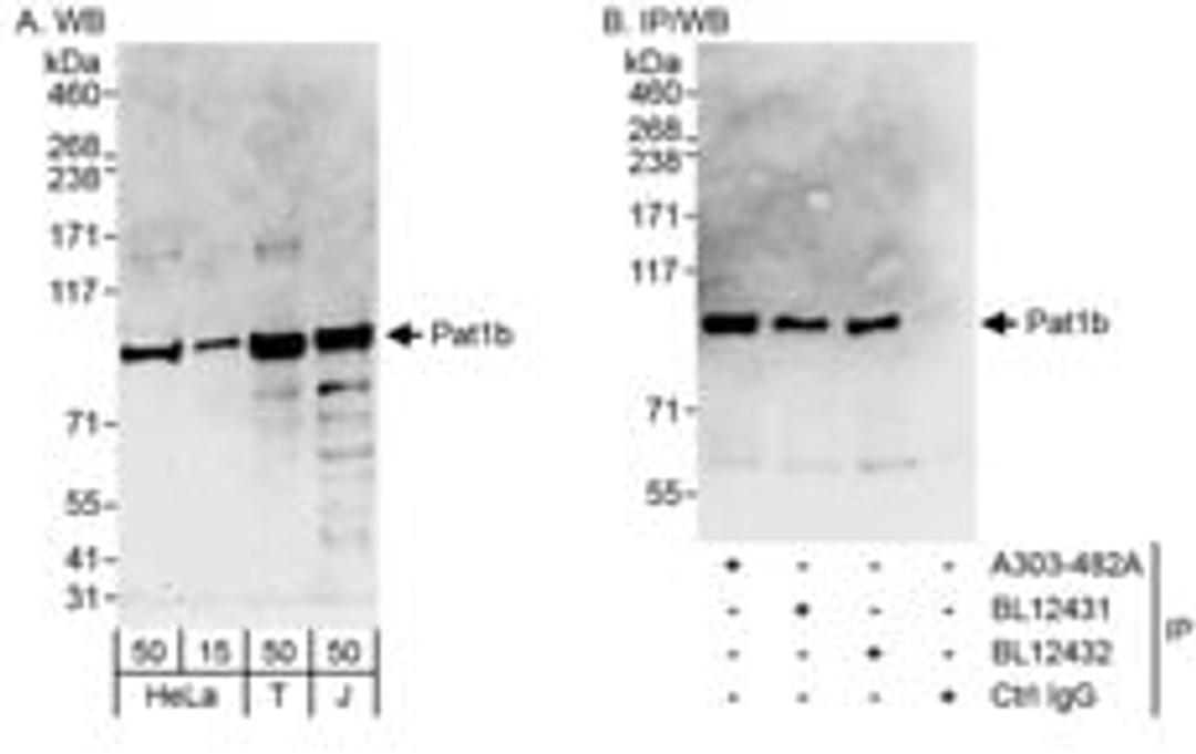 Detection of human Pat1b by western blot and immunoprecipitation.