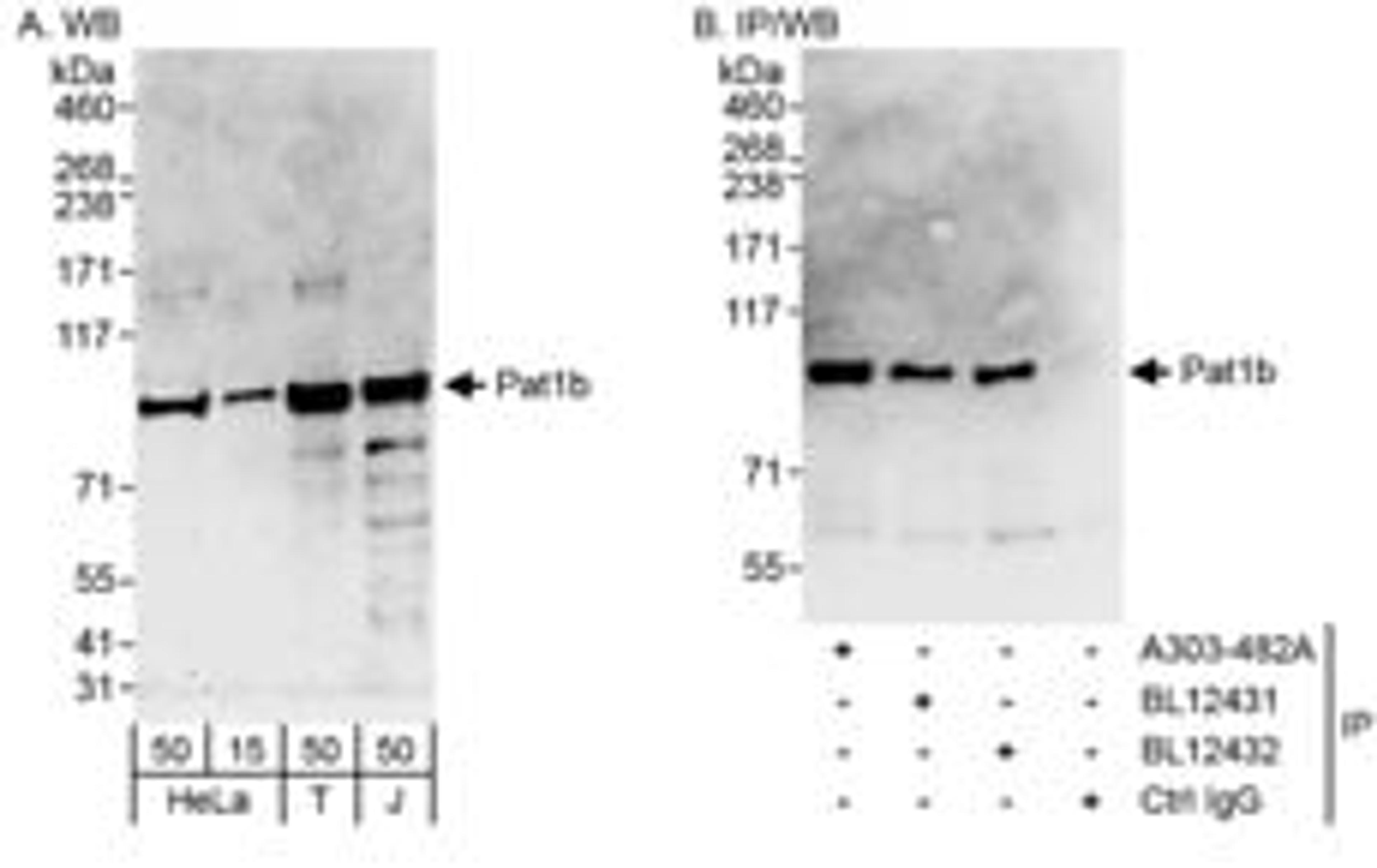 Detection of human Pat1b by western blot and immunoprecipitation.