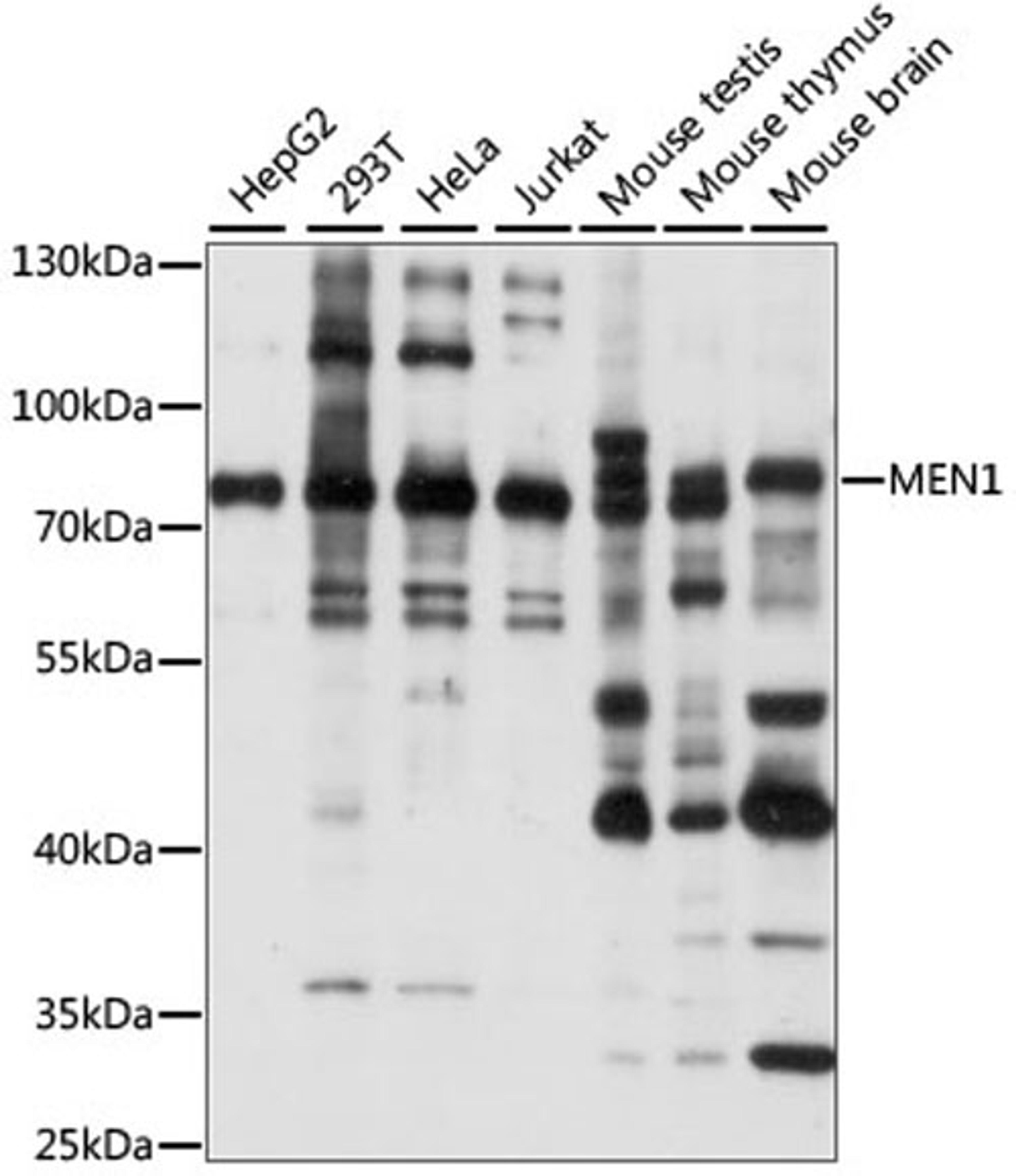 Western blot - MEN1 antibody (A15290)