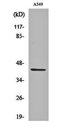 Western blot analysis of A549 cell lysates using Cleaved-MMP-3 (F100) antibody