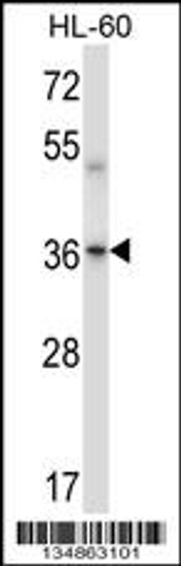 Western blot analysis in HL-60 cell line lysates (35ug/lane).This demonstrates the Prkaca/Prkacb antibody detected the Prkaca/Prkacb protein (arrow).