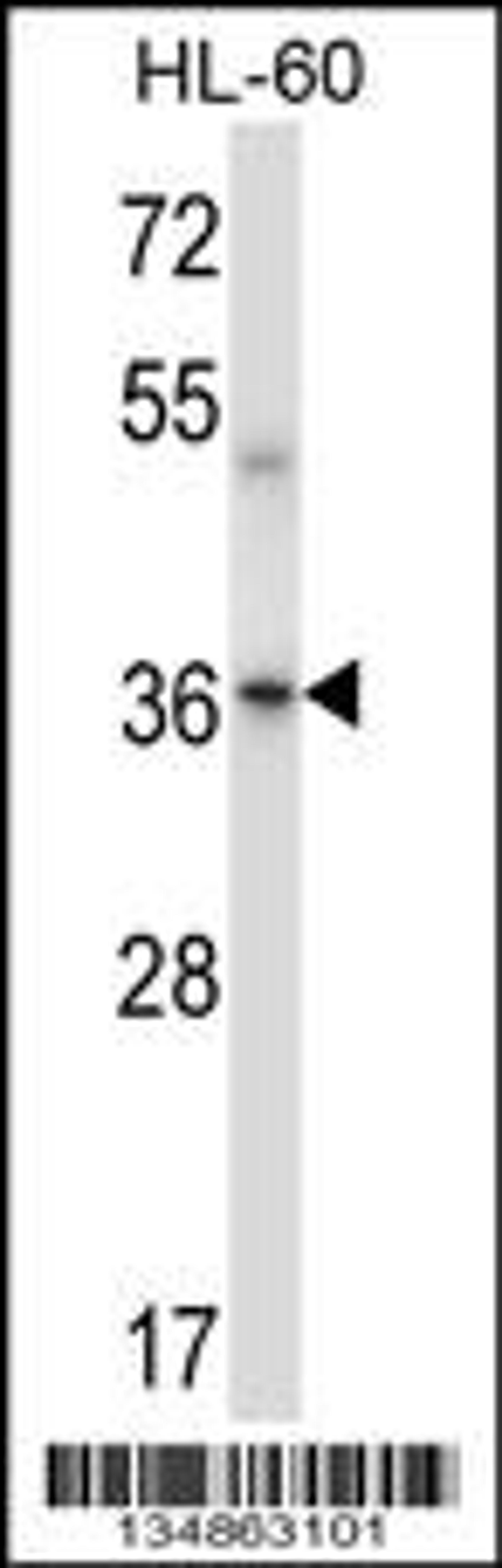 Western blot analysis in HL-60 cell line lysates (35ug/lane).This demonstrates the Prkaca/Prkacb antibody detected the Prkaca/Prkacb protein (arrow).