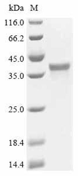 (Tris-Glycine gel) Discontinuous SDS-PAGE (reduced) with 5% enrichment gel and 15% separation gel.