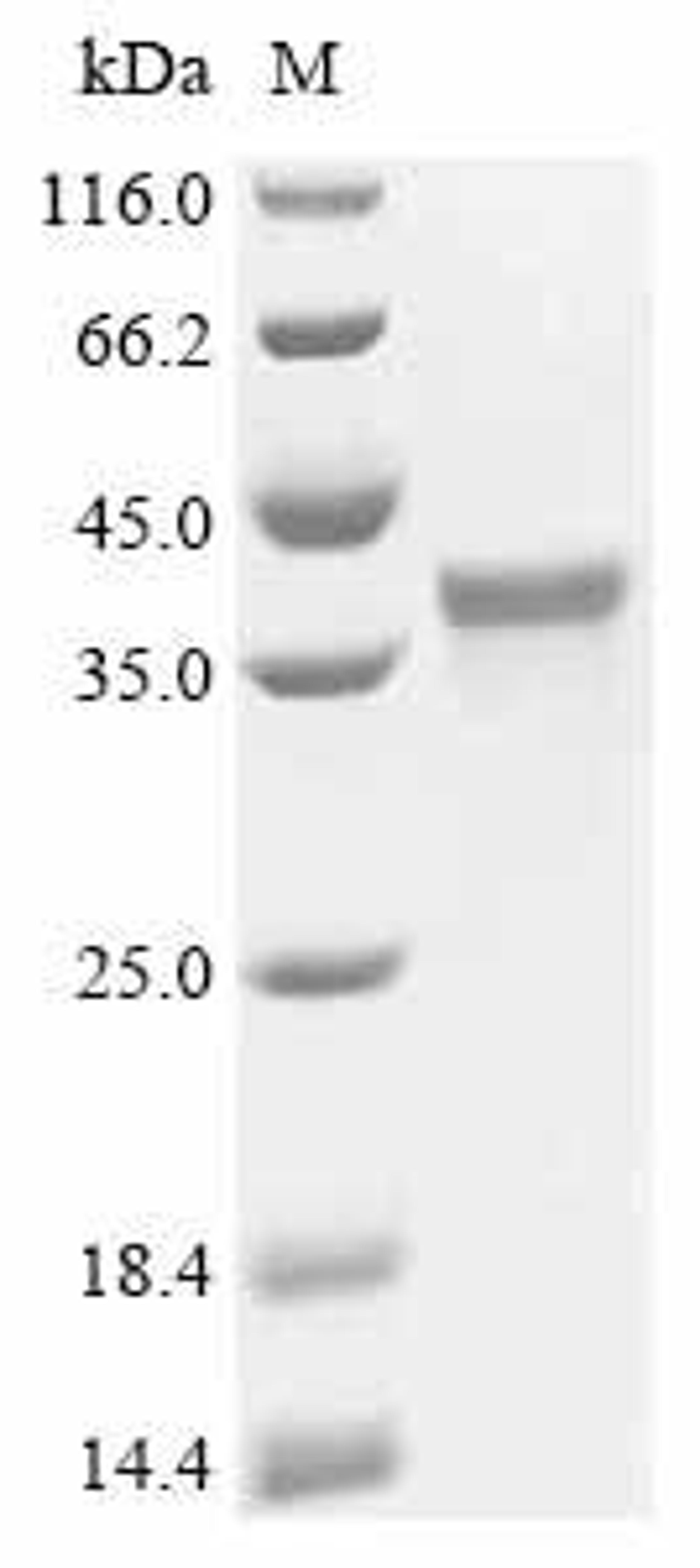 (Tris-Glycine gel) Discontinuous SDS-PAGE (reduced) with 5% enrichment gel and 15% separation gel.