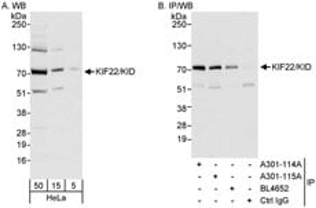 Detection of human KIF22/KID by western blot and immunoprecipitation.