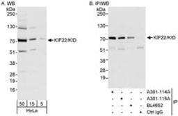 Detection of human KIF22/KID by western blot and immunoprecipitation.