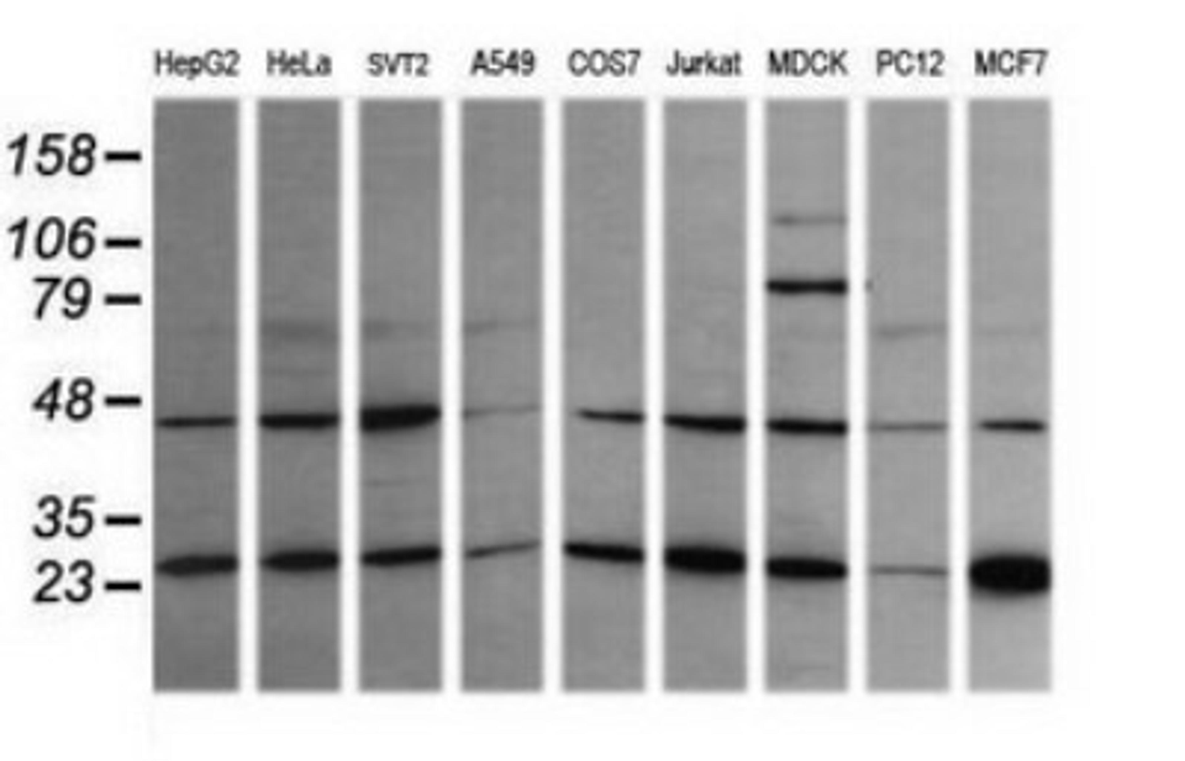 Western Blot: RAB21 Antibody (6E12) [NBP2-45497] - Analysis of extracts (35ug) from 9 different cell lines (HepG2: human; HeLa: human; SVT2: mouse; A549: human; COS7: monkey; Jurkat: human; MDCK: canine; PC12: rat; MCF7: human).