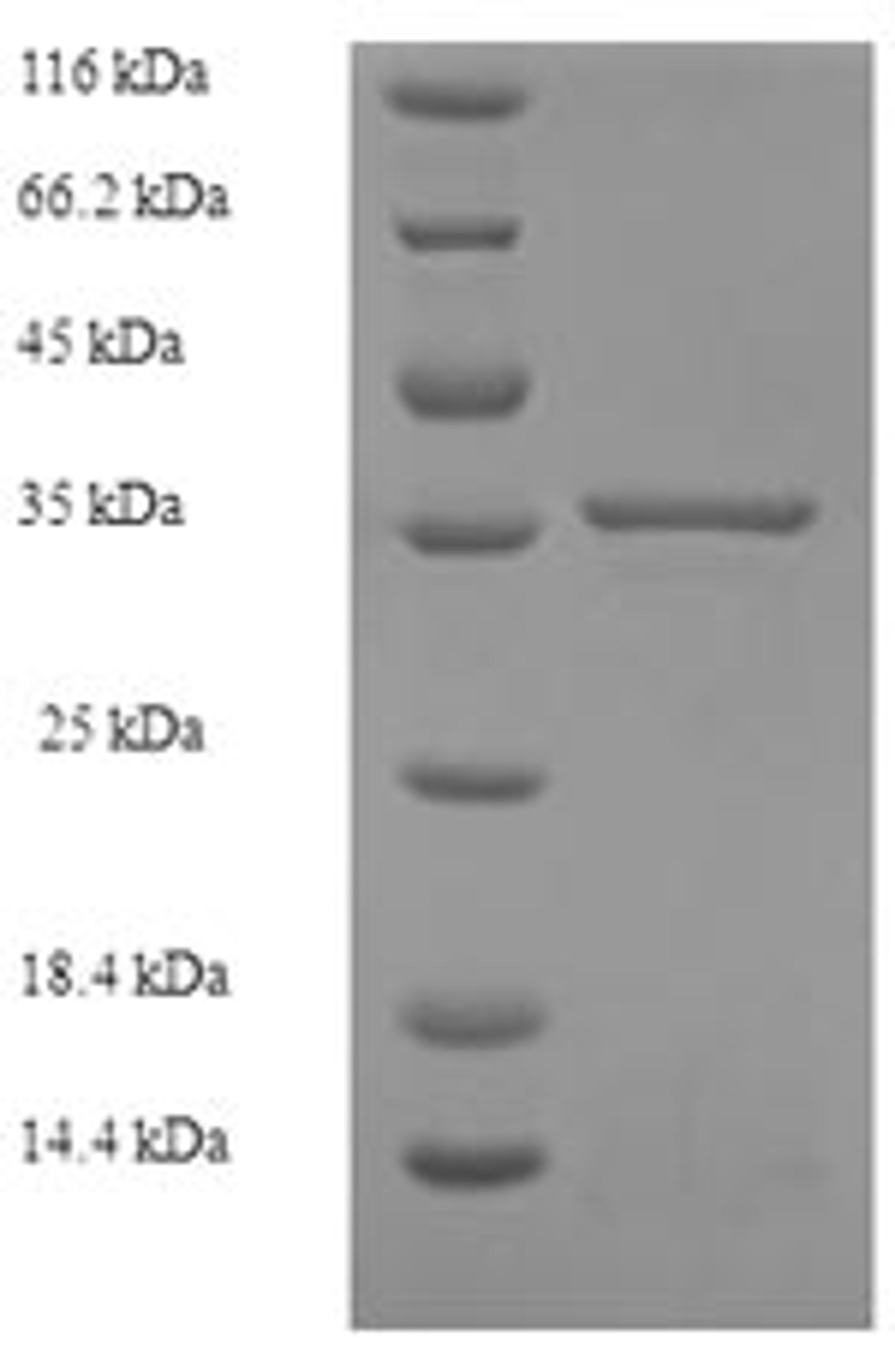 (Tris-Glycine gel) Discontinuous SDS-PAGE (reduced) with 5% enrichment gel and 15% separation gel.