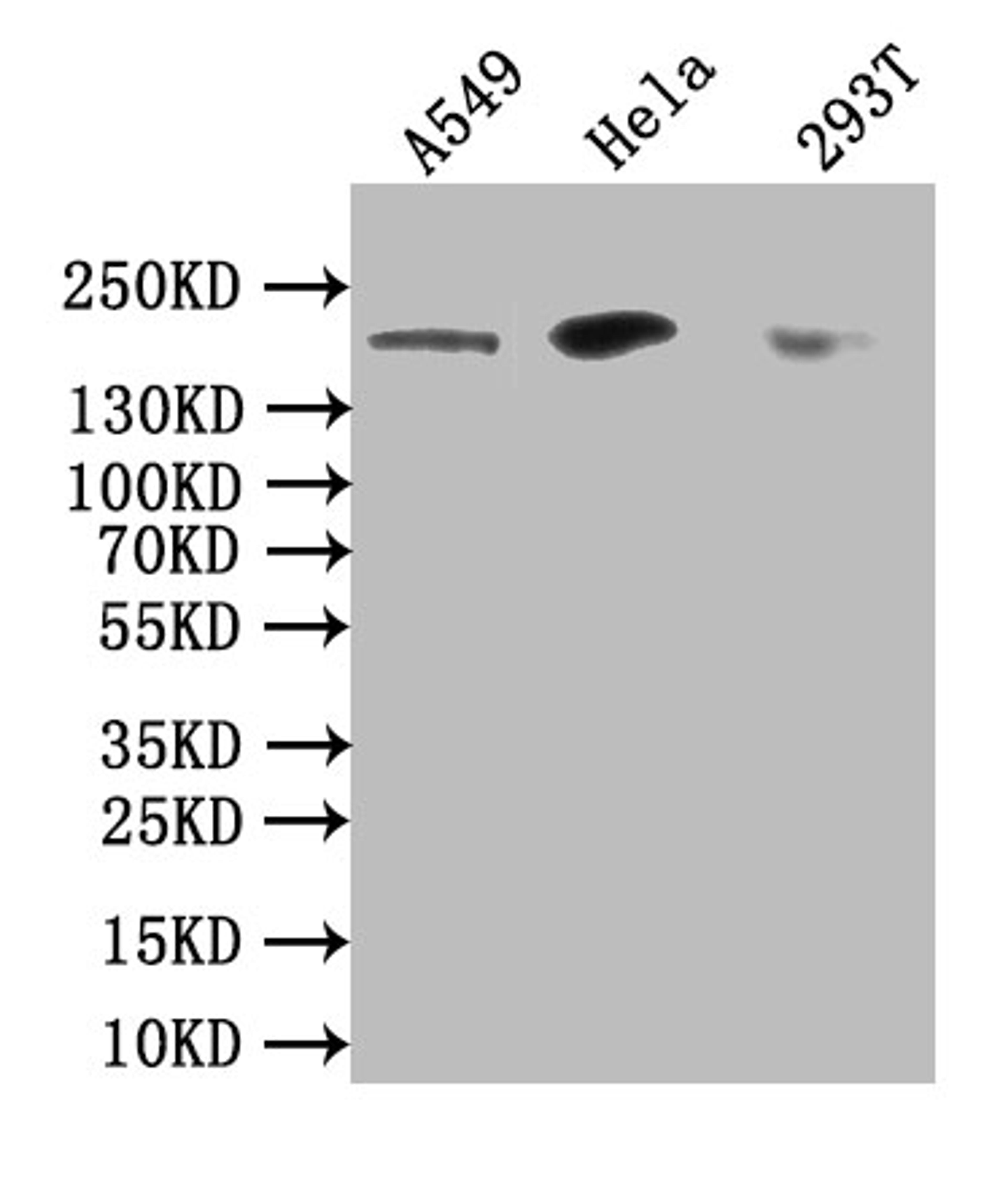 Western Blot. Positive WB detected in: Hela whole cell lysate, HL60 whole cell lysate, K562 whole cell lysate, SH-SY5Y whole cell lysate, U251 whole cell lysate, PC-3 whole cell lysate. All lanes: DOT1L antibody at 1:1500. Secondary. Goat polyclonal to rabbit IgG at 1/50000 dilution. Predicted band size: 165, 185 kDa. Observed band size: 185 kDa. 