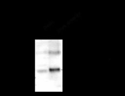 GABA A Receptor gamma 2, CT Antibody