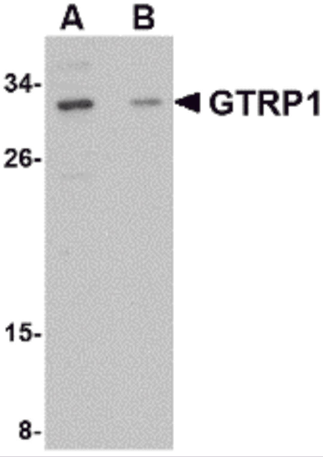 Western blot analysis of GRTP1 in SK-N-SH cell lysate with GRTP1 antibody at 1 &#956;g/mL in the (A) absence and (B) presence of blocking peptide.