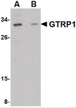 Western blot analysis of GRTP1 in SK-N-SH cell lysate with GRTP1 antibody at 1 &#956;g/mL in the (A) absence and (B) presence of blocking peptide.