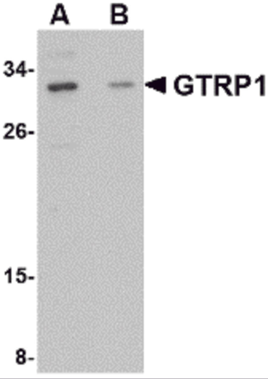 Western blot analysis of GRTP1 in SK-N-SH cell lysate with GRTP1 antibody at 1 μg/mL in the (A) absence and (B) presence of blocking peptide.