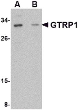 Western blot analysis of GRTP1 in SK-N-SH cell lysate with GRTP1 antibody at 1 μg/mL in the (A) absence and (B) presence of blocking peptide.