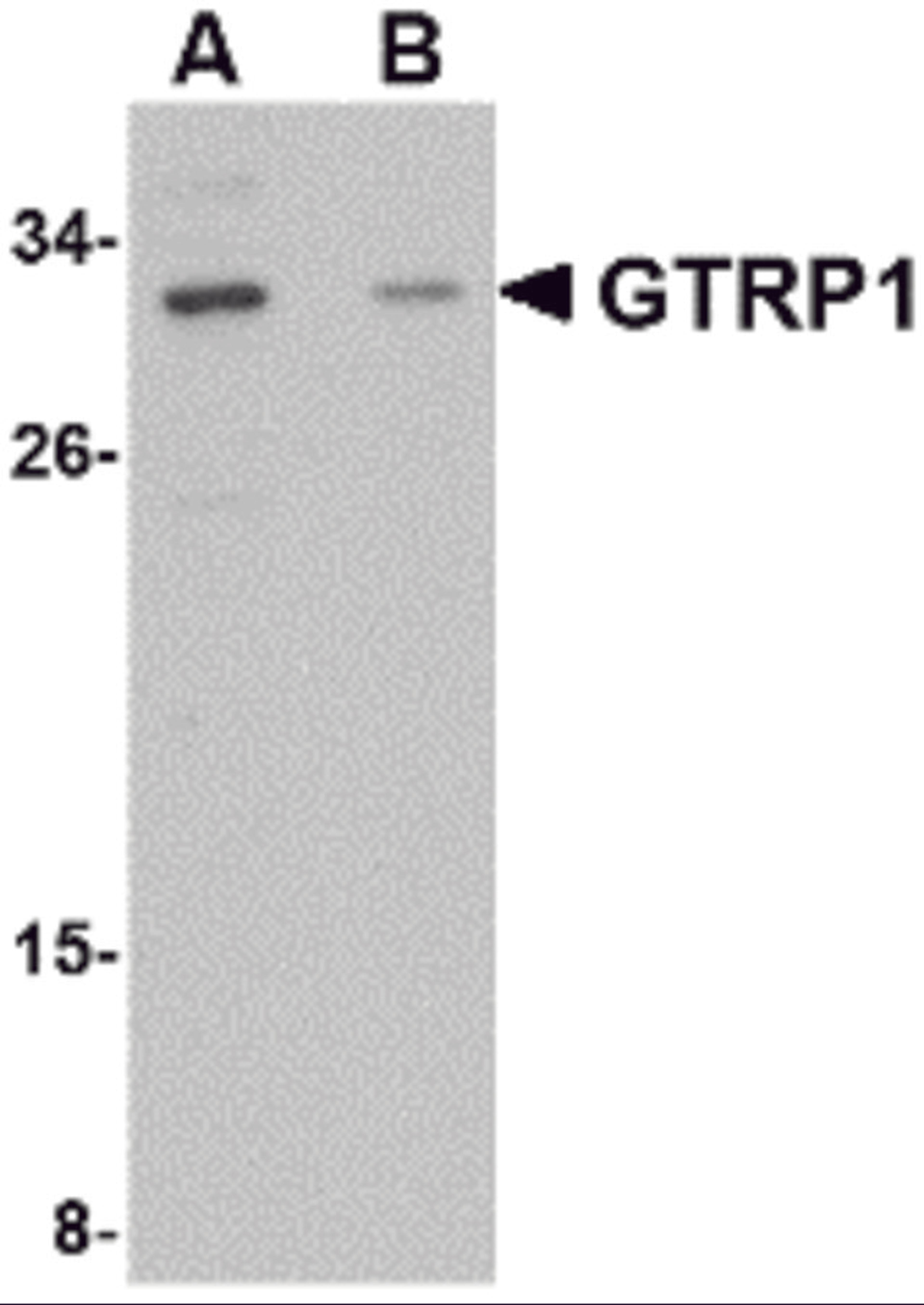 Western blot analysis of GRTP1 in SK-N-SH cell lysate with GRTP1 antibody at 1 μg/mL in the (A) absence and (B) presence of blocking peptide.