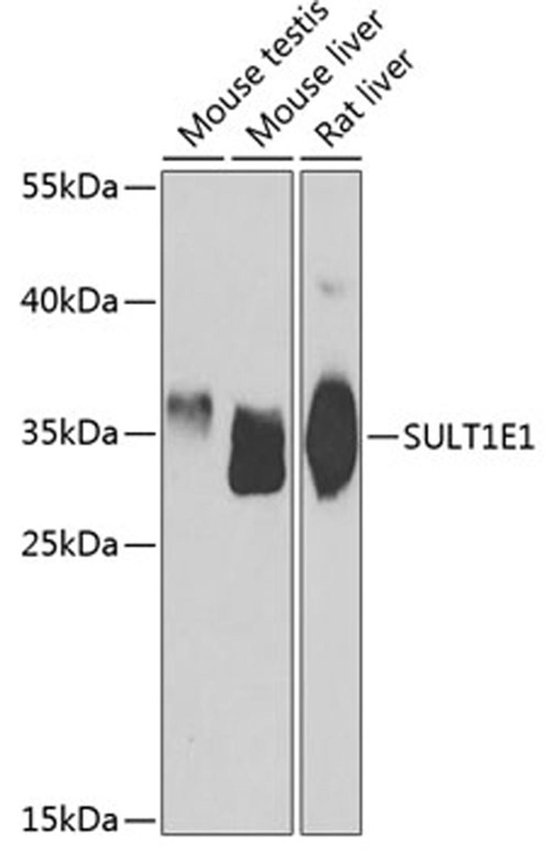 Western blot - SULT1E1 antibody (A7452)