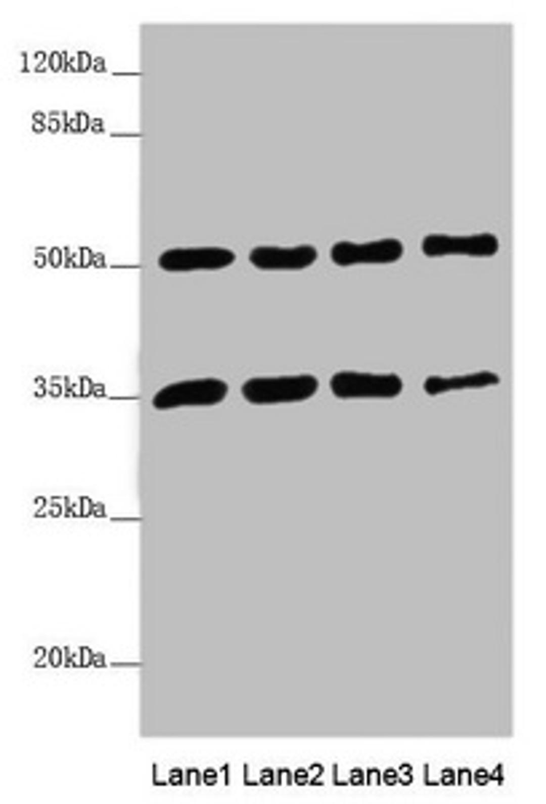 Western blot. All lanes: MTX1 antibody at 3.78µg/ml. Lane 1: Jurkat whole cell lysate. Lane 2: A549 whole cell lysate. Lane 3: HepG2 whole cell lysate. Lane 4: MCF-7 whole cell lysate. Secondary. Goat polyclonal to rabbit IgG at 1/10000 dilution. Predicted band size: 52, 48, 36 kDa. Observed band size: 52, 36 kDa