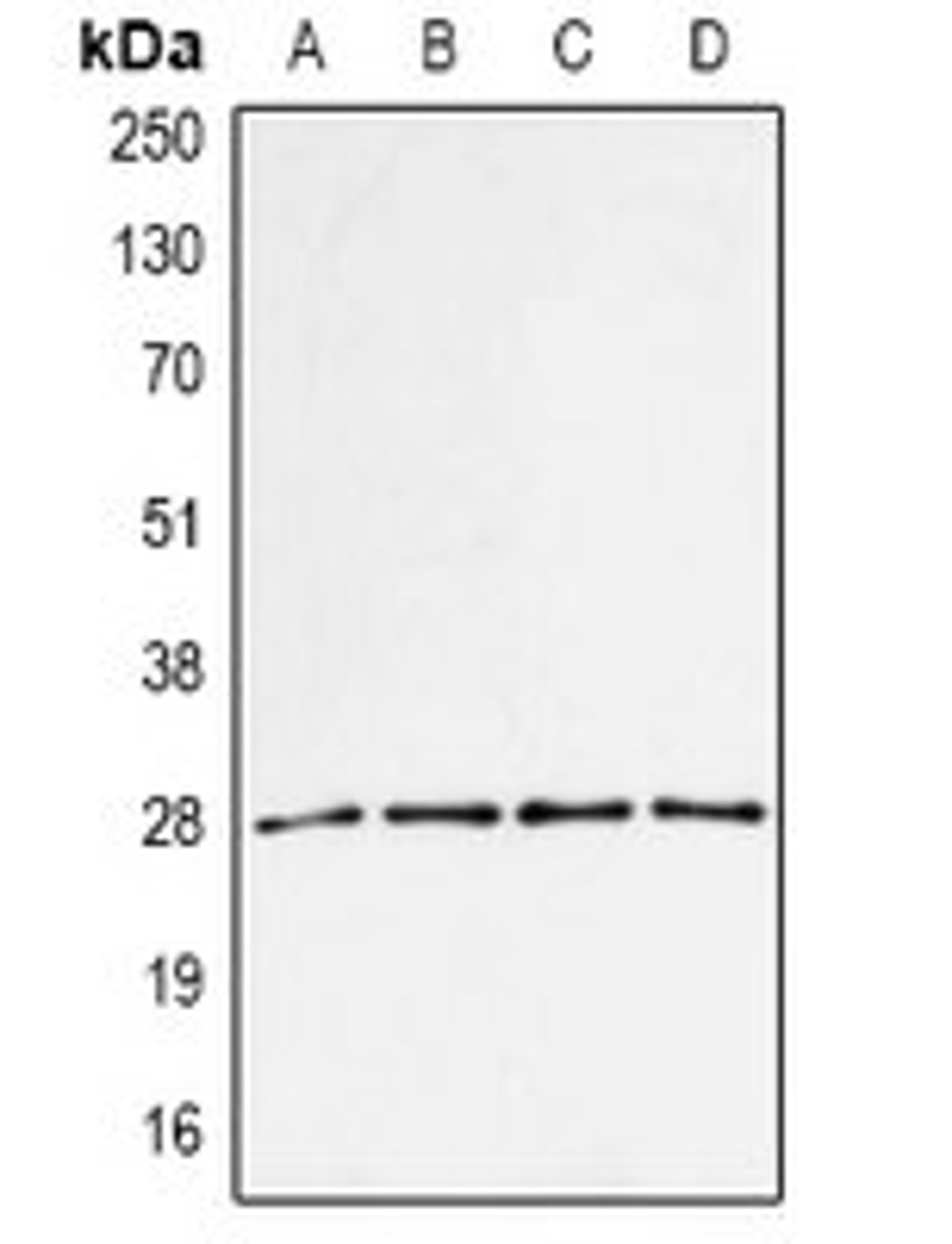 Western blot analysis of MCF7 (Lane1), BT474 (Lane2), mouse spleen (Lane3), mouse liver (Lane4) whole cell lysates using PSME1 antibody