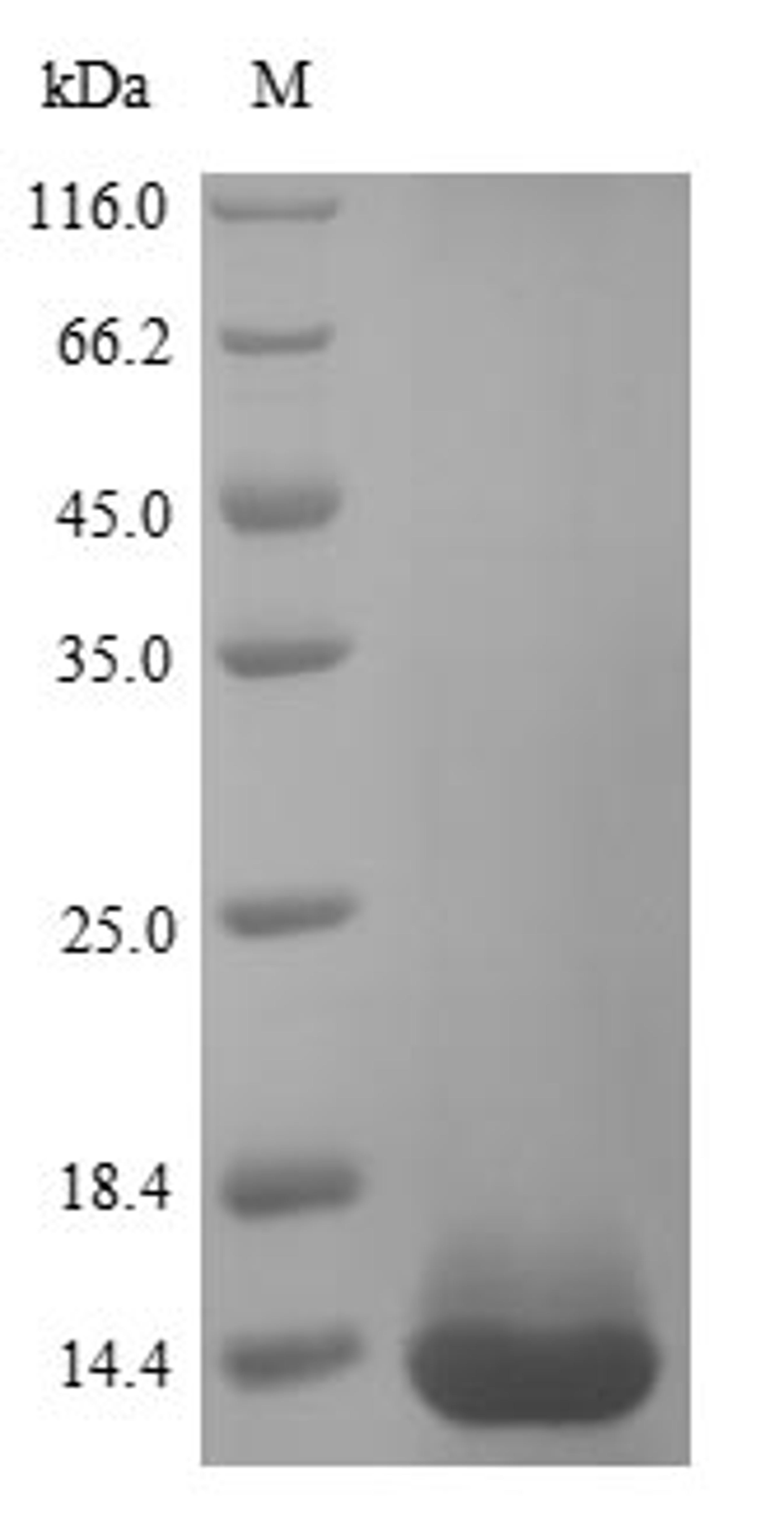 (Tris-Glycine gel) Discontinuous SDS-PAGE (reduced) with 5% enrichment gel and 15% separation gel.