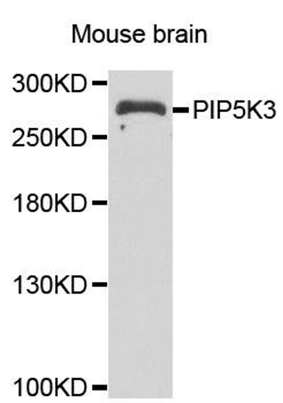 Western blot analysis of extracts of Mouse brain cell line using PIP5K3 antibody