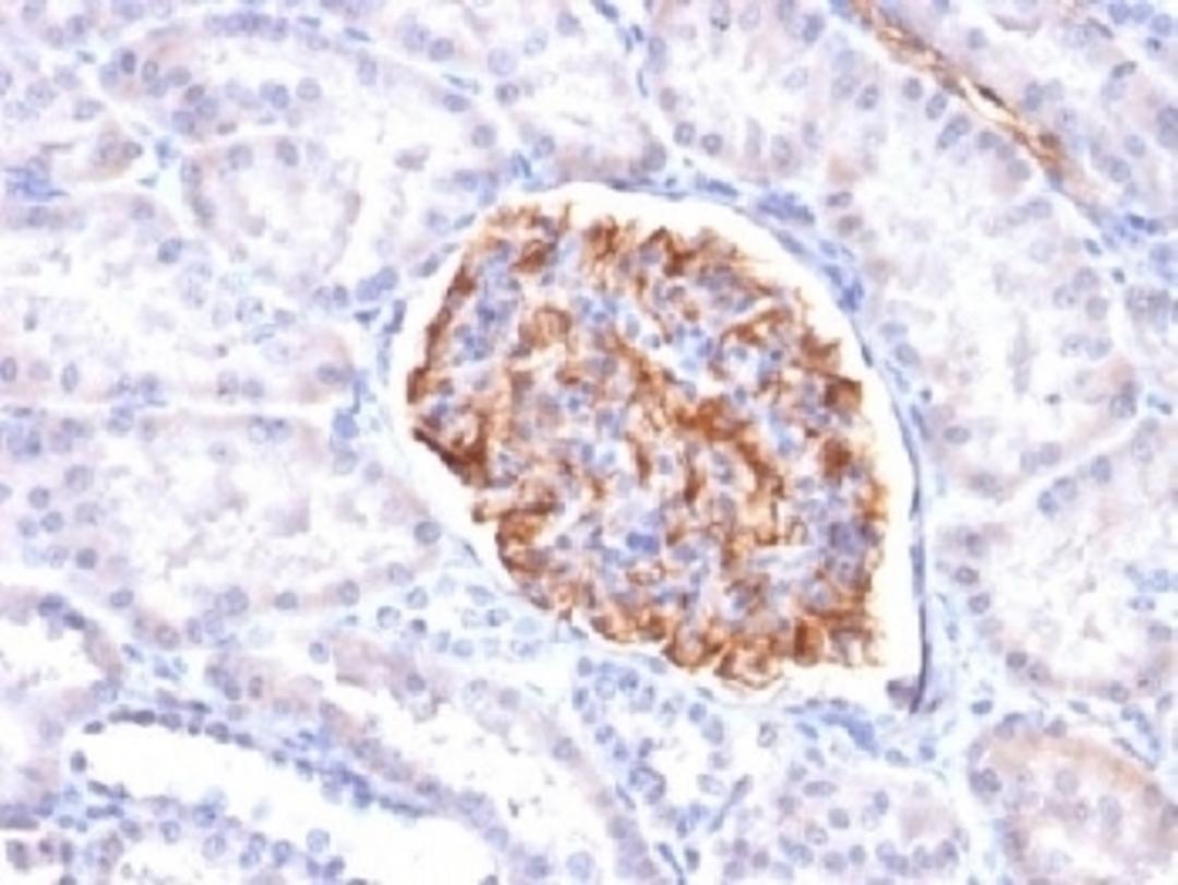 IHC testing of FFPE human kidney with recombinant WT1 antibody (clone rWT1/857). Required HIER: boil tissue sections in 10mM citrate buffer, pH 6, for 10-20 min followed by cooling at RT for 20 min.