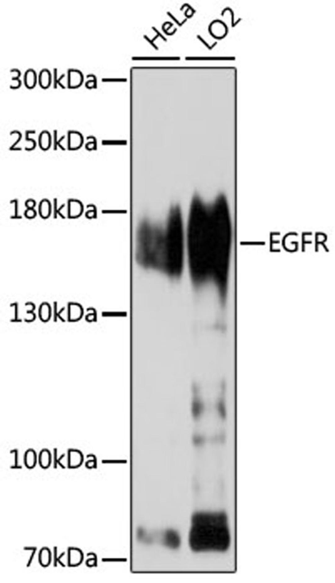 Western blot - EGFR antibody (A11082)