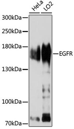 Western blot - EGFR antibody (A11082)