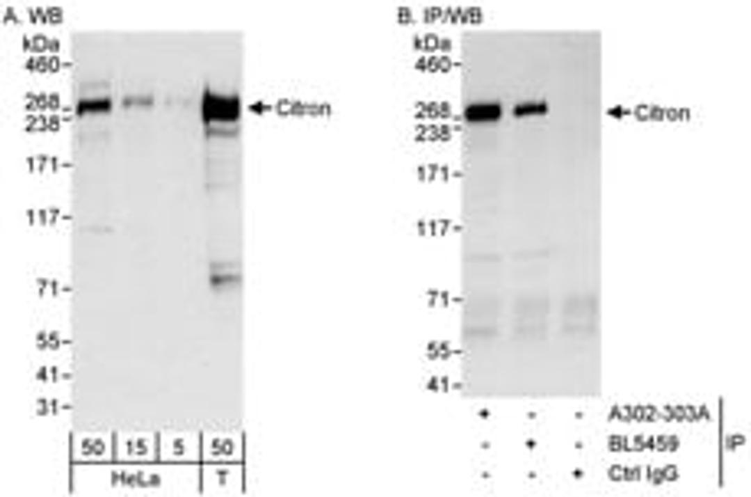 Detection of human Citron by western blot and immunoprecipitation.