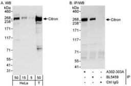 Detection of human Citron by western blot and immunoprecipitation.