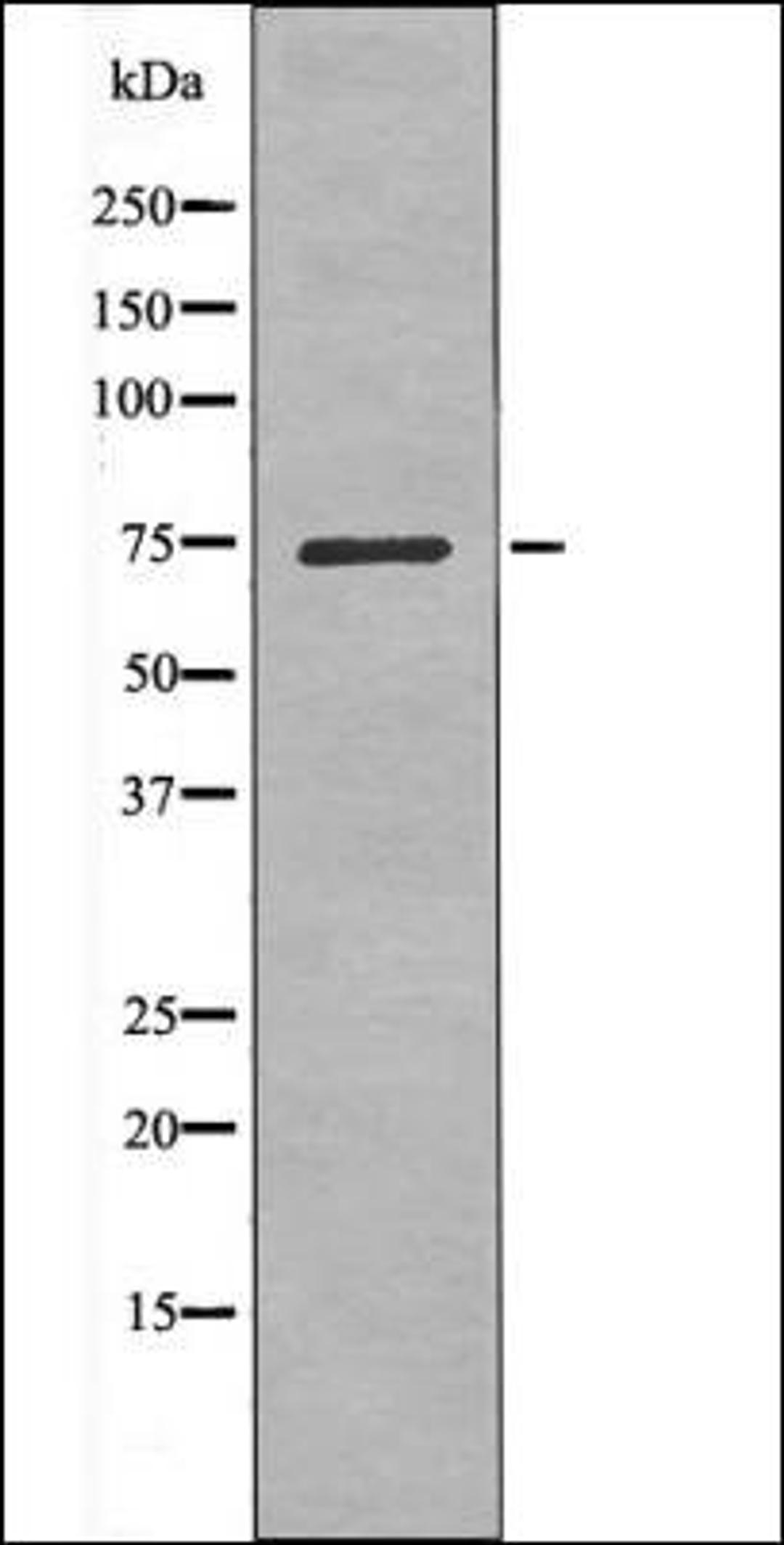 Western blot analysis of Insulin treated Jurkat whole cell lysates using LIMK1 -Phospho-Ser323- antibody