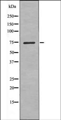 Western blot analysis of Insulin treated Jurkat whole cell lysates using LIMK1 -Phospho-Ser323- antibody