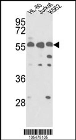 Western blot analysis of hPRKCABP-C300 in HL-60, Jurkat, K562 cell line lysates (35ug/lane)