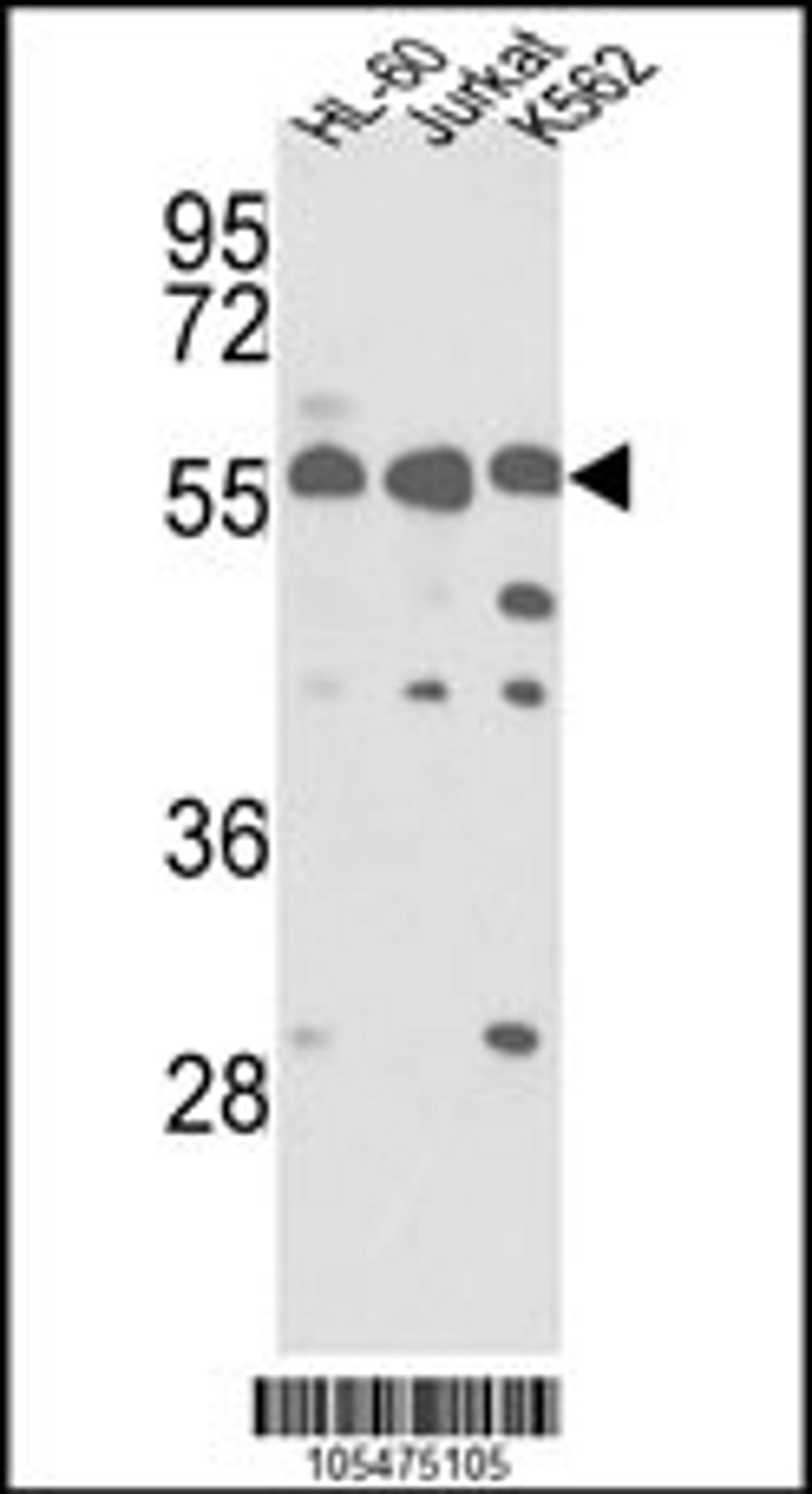 Western blot analysis of hPRKCABP-C300 in HL-60, Jurkat, K562 cell line lysates (35ug/lane)