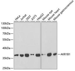 Western blot - AKR1B1 antibody (A1684)