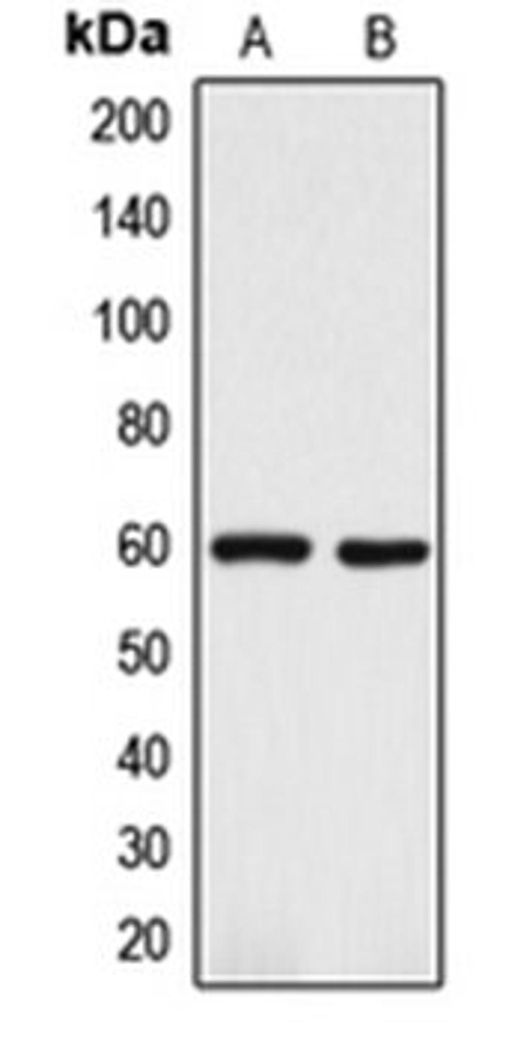 Western blot analysis of A375 (Lane 1), Y79 (Lane 2) whole cell lysates using DCT antibody