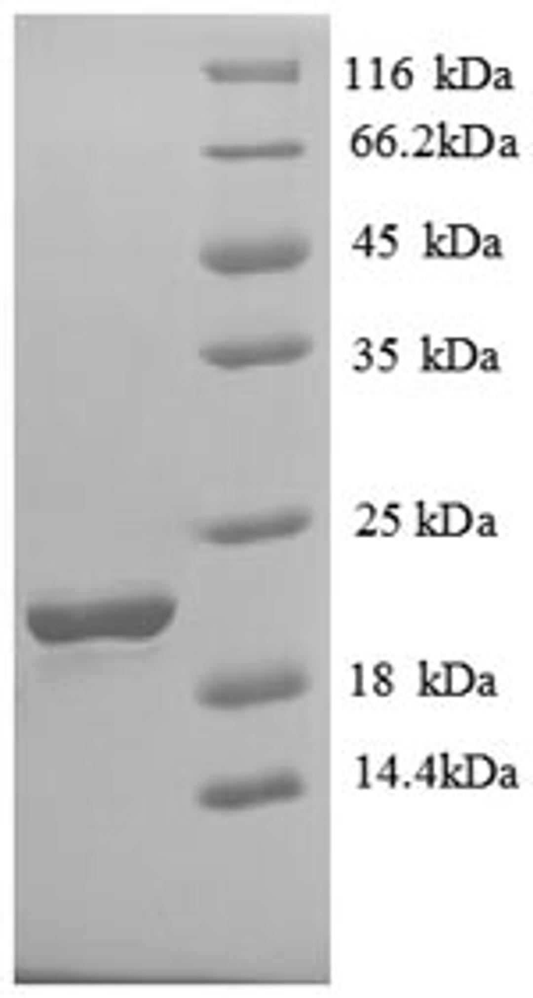 (Tris-Glycine gel) Discontinuous SDS-PAGE (reduced) with 5% enrichment gel and 15% separation gel.